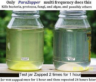 ParaZapper zaps microbes quickly